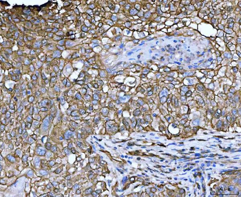 EPLIN/LIMA1 Rabbit Polyclonal Antibody