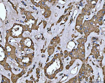 EPLIN/LIMA1 Rabbit Polyclonal Antibody