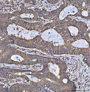 HSD17B7 Rabbit Polyclonal Antibody