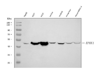 Epoxide hydrolase/EPHX1 Rabbit Polyclonal Antibody