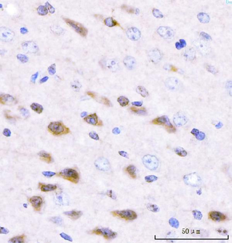 Adgrg1 Rabbit Polyclonal Antibody