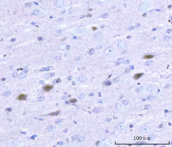 Adgrg1 Rabbit Polyclonal Antibody