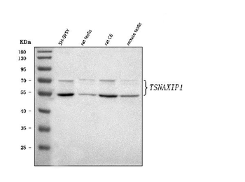 TSNAXIP1 Rabbit Polyclonal Antibody
