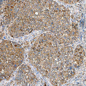 SLC40A1 Antibody