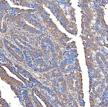SLC40A1 Antibody
