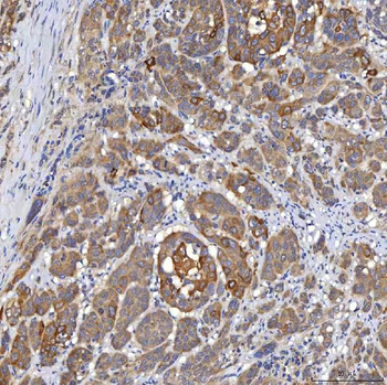 OAT3/SLC22A8 Antibody