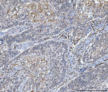 NHERF-2/SIP-1/SLC9A3R2/NHERF Rabbit Polyclonal Antibody