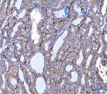 NHERF-2/SIP-1/SLC9A3R2/NHERF Rabbit Polyclonal Antibody