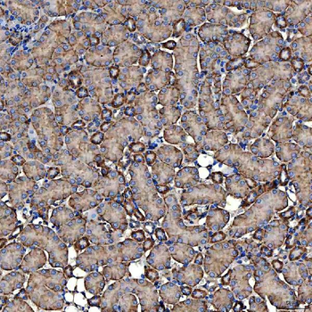 NHERF-2/SIP-1/SLC9A3R2/NHERF Rabbit Polyclonal Antibody