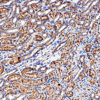 NHERF-2/SIP-1/SLC9A3R2/NHERF Rabbit Polyclonal Antibody