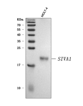 SIVA/SIVA1 Rabbit Polyclonal Antibody