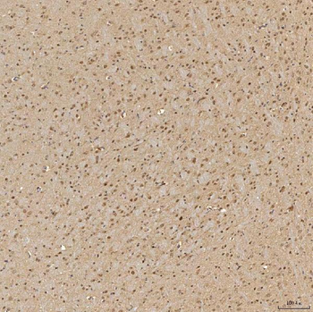 SINHCAF Rabbit Polyclonal Antibody