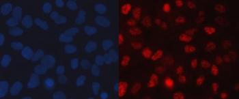 SINHCAF Rabbit Polyclonal Antibody