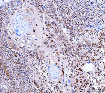 SINHCAF Rabbit Polyclonal Antibody