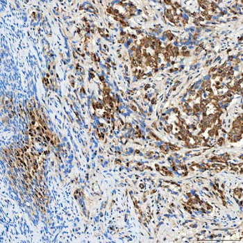 SINHCAF Rabbit Polyclonal Antibody
