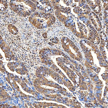 SINHCAF Rabbit Polyclonal Antibody