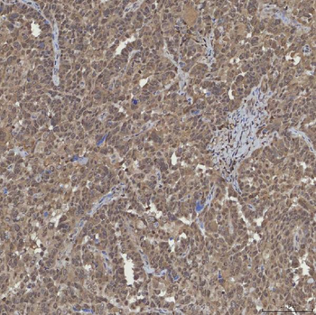 mSin3A/SIN3A Rabbit Polyclonal Antibody
