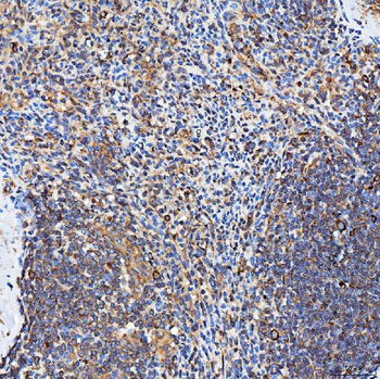 SH2D4A Rabbit Polyclonal Antibody