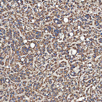SH2D4A Rabbit Polyclonal Antibody