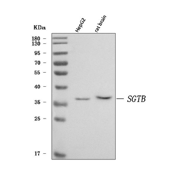 SGT2/SGTB Rabbit Polyclonal Antibody
