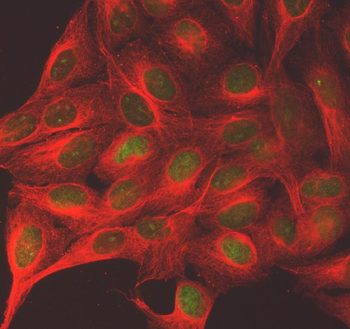 SGO2 Rabbit Polyclonal Antibody