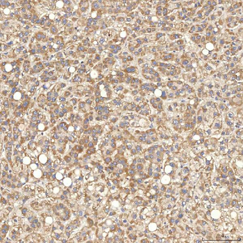 SGCE Rabbit Polyclonal Antibody