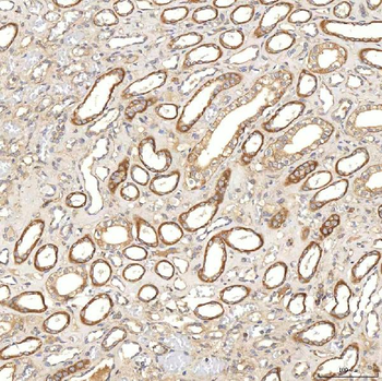 SGCE Rabbit Polyclonal Antibody