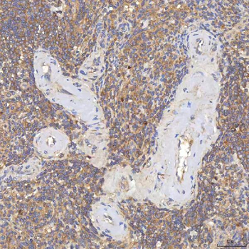SGCE Rabbit Polyclonal Antibody