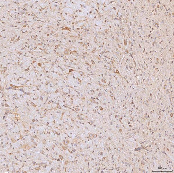 SGCE Rabbit Polyclonal Antibody
