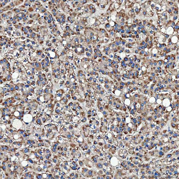 SFXN3 Rabbit Polyclonal Antibody