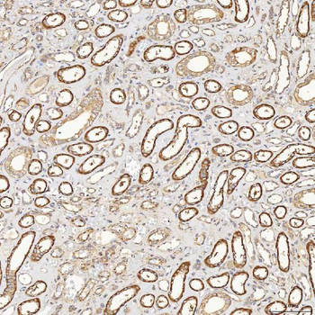 SFXN3 Rabbit Polyclonal Antibody