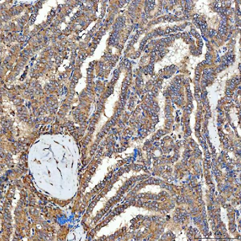 SFXN3 Rabbit Polyclonal Antibody