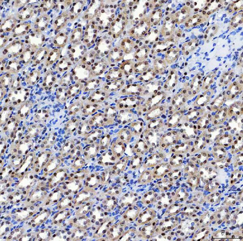 SF3A1 Rabbit Polyclonal Antibody