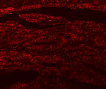 SF3A1 Rabbit Polyclonal Antibody