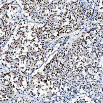SF3A1 Rabbit Polyclonal Antibody