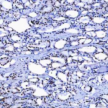 SF3A1 Rabbit Polyclonal Antibody