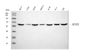 SETD3 Antibody