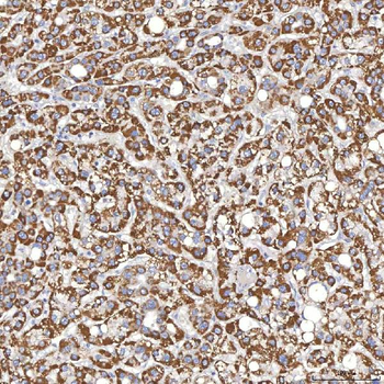Thyroxine Binding Globulin/SERPINA7 Rabbit Polyclonal Antibody