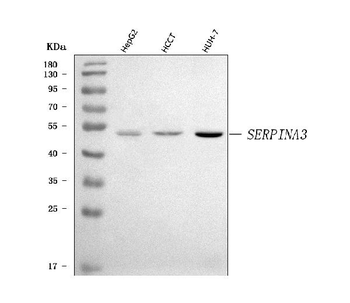 AACT/SERPINA3 Rabbit Polyclonal Antibody