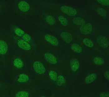 SERINC2 Rabbit Polyclonal Antibody