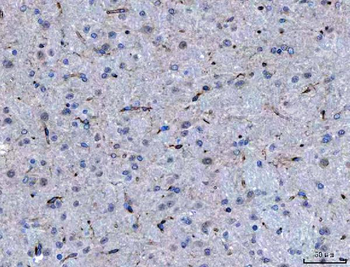 SEMA4F Rabbit Polyclonal Antibody