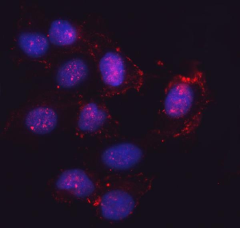SEMA4F Rabbit Polyclonal Antibody