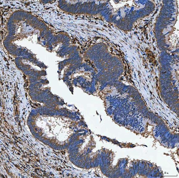SEMA4F Rabbit Polyclonal Antibody