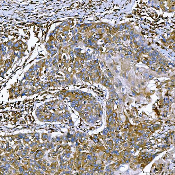 SEMA4F Rabbit Polyclonal Antibody