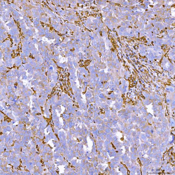 SEMA4F Rabbit Polyclonal Antibody