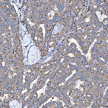SEMA4F Rabbit Polyclonal Antibody