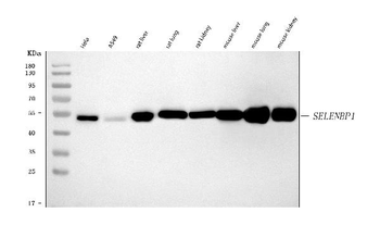 SBP/SELENBP1 Rabbit Polyclonal Antibody