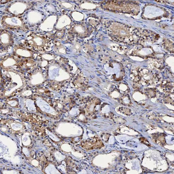 SBP/SELENBP1 Rabbit Polyclonal Antibody