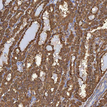SBP/SELENBP1 Rabbit Polyclonal Antibody