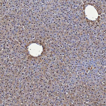 SBP/SELENBP1 Rabbit Polyclonal Antibody